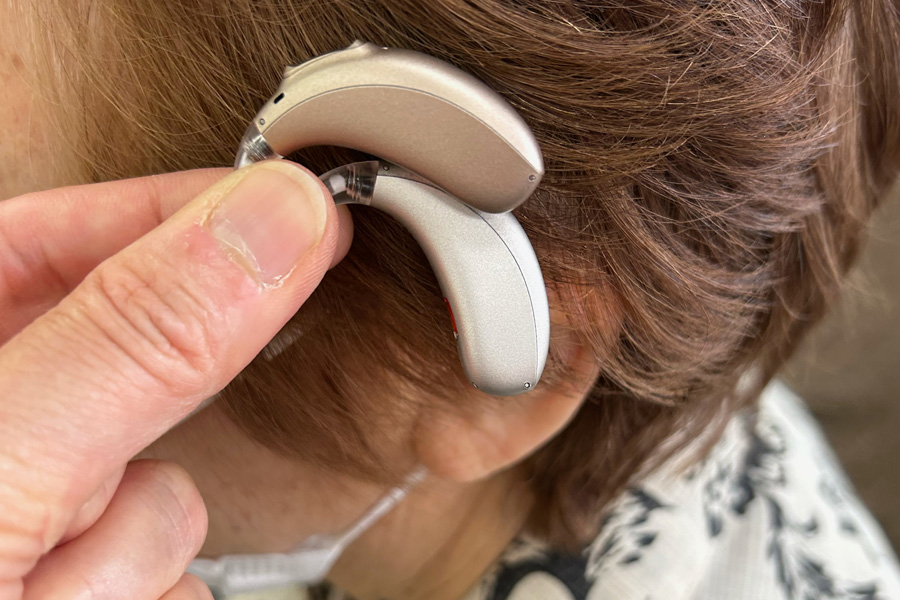 調整（フィッティング）